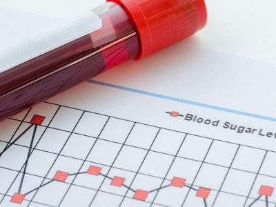 Glucose Tolerance test